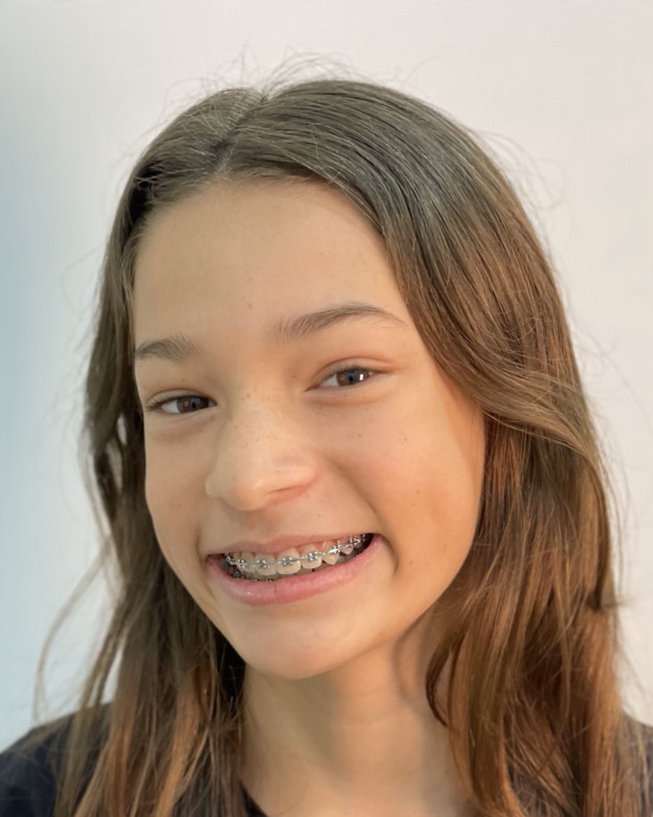 IMG_0496 (Personalizado)