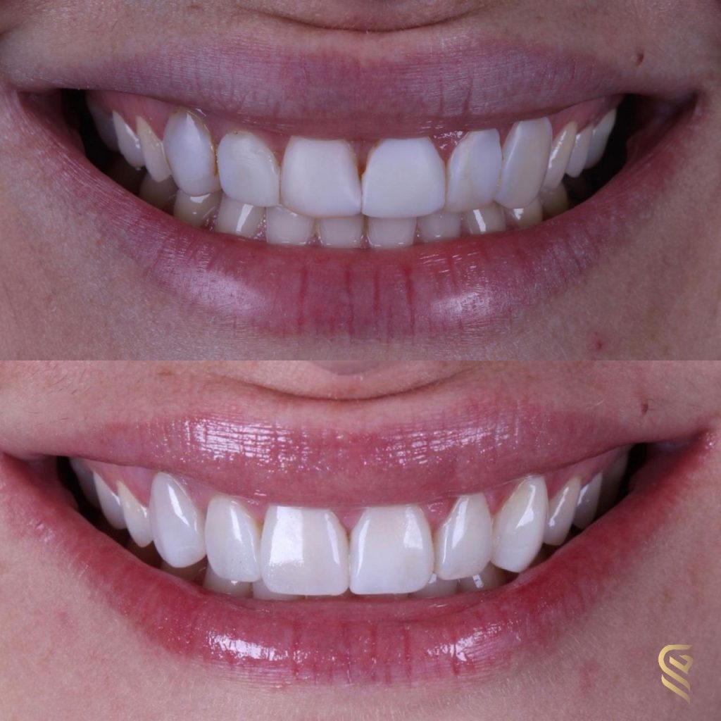 94bdeb16-b359-46bf-b96c-5329fcab1905