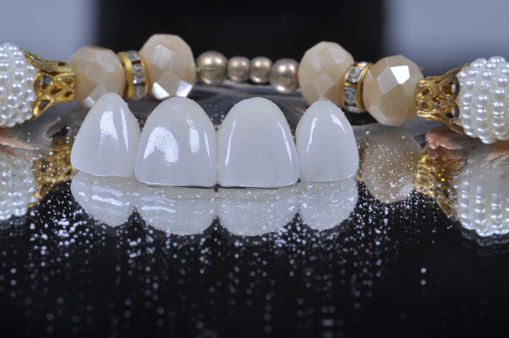 _DSC0066 (Personalizado)