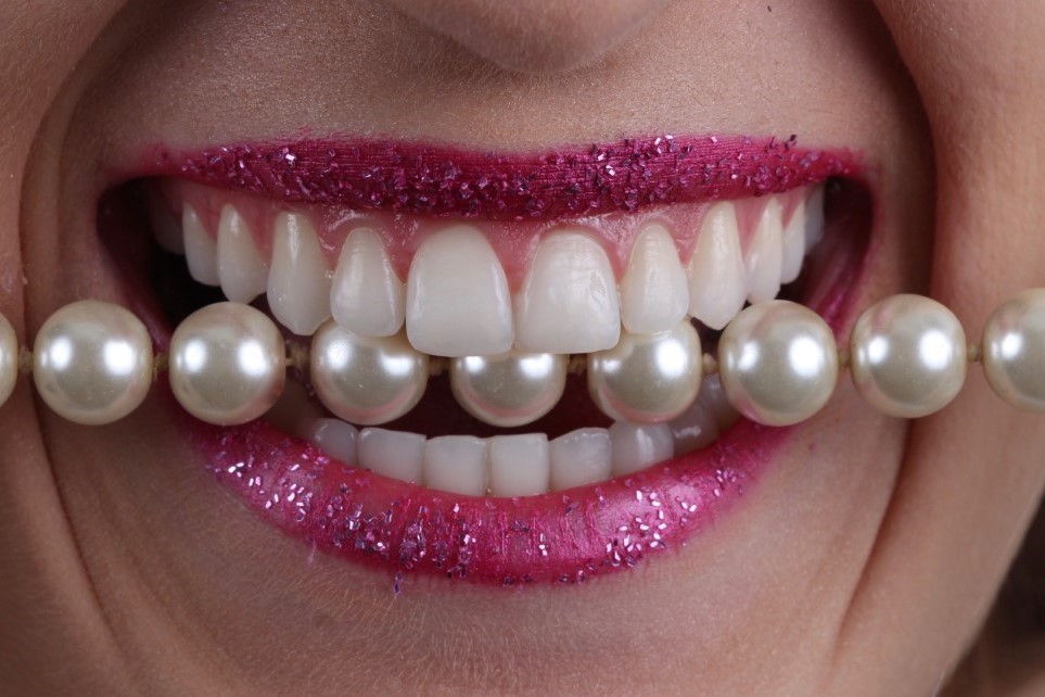 IMG_0145 (Personalizado)