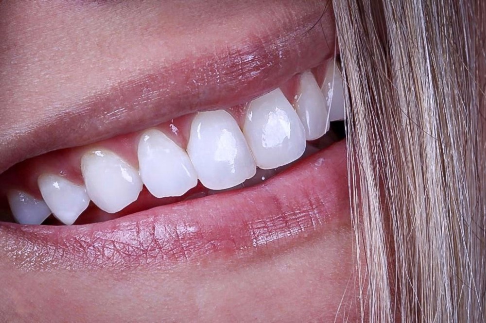 fe694406-dbb1-460f-95a6-014610ebb9bb (Personalizado)